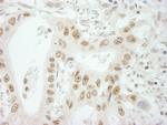 SKIV2L2 Antibody in Immunohistochemistry (Paraffin) (IHC (P))