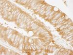 KARS Antibody in Immunohistochemistry (Paraffin) (IHC (P))