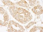 KARS Antibody in Immunohistochemistry (Paraffin) (IHC (P))