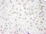 PAF49 Antibody in Immunohistochemistry (Paraffin) (IHC (P))