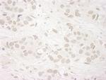 JARID1A/RBP2 Antibody in Immunohistochemistry (Paraffin) (IHC (P))