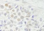 BCAS3 Antibody in Immunohistochemistry (Paraffin) (IHC (P))