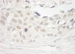 PPP1CB Antibody in Immunohistochemistry (Paraffin) (IHC (P))