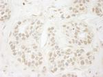 PPP3CA Antibody in Immunohistochemistry (Paraffin) (IHC (P))