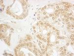 PPP3CA Antibody in Immunohistochemistry (Paraffin) (IHC (P))