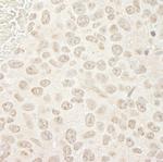 PPP3CA Antibody in Immunohistochemistry (Paraffin) (IHC (P))