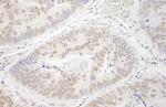 PRMT6 Antibody in Immunohistochemistry (Paraffin) (IHC (P))