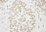 PRMT6 Antibody in Immunohistochemistry (Paraffin) (IHC (P))