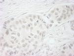 BubR1 Antibody in Immunohistochemistry (Paraffin) (IHC (P))