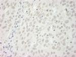 BubR1 Antibody in Immunohistochemistry (Paraffin) (IHC (P))