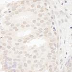 CASC5 Antibody in Immunohistochemistry (Paraffin) (IHC (P))