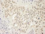 USP15 Antibody in Immunohistochemistry (Paraffin) (IHC (P))