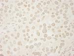 USP33 Antibody in Immunohistochemistry (Paraffin) (IHC (P))