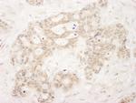 QSER1 Antibody in Immunohistochemistry (Paraffin) (IHC (P))