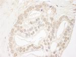 QSER1 Antibody in Immunohistochemistry (Paraffin) (IHC (P))