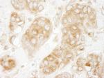 GIT1 Antibody in Immunohistochemistry (Paraffin) (IHC (P))