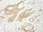 Notch1 Antibody in Immunohistochemistry (Paraffin) (IHC (P))