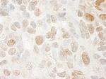 SRcyp Antibody in Immunohistochemistry (Paraffin) (IHC (P))