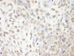 CPSF100 Antibody in Immunohistochemistry (Paraffin) (IHC (P))