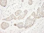 NP95/UHRF1 Antibody in Immunohistochemistry (Paraffin) (IHC (P))