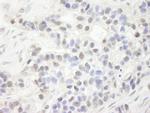 NP95/UHRF1 Antibody in Immunohistochemistry (Paraffin) (IHC (P))