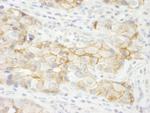 KIAA0528 Antibody in Immunohistochemistry (Paraffin) (IHC (P))