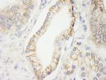 KIAA0528 Antibody in Immunohistochemistry (Paraffin) (IHC (P))