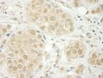 THOC5 Antibody in Immunohistochemistry (Paraffin) (IHC (P))