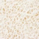 Leo1 Antibody in Immunohistochemistry (Paraffin) (IHC (P))