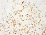 QKI Antibody in Immunohistochemistry (Paraffin) (IHC (P))