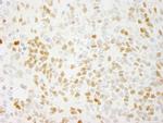 QKI Antibody in Immunohistochemistry (Paraffin) (IHC (P))