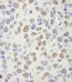 SAM68 Antibody in Immunohistochemistry (Paraffin) (IHC (P))