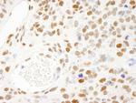 KSRP Antibody in Immunohistochemistry (Paraffin) (IHC (P))