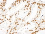 KSRP Antibody in Immunohistochemistry (Paraffin) (IHC (P))