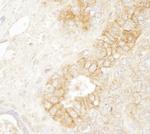 Beta-catenin Antibody in Immunohistochemistry (Paraffin) (IHC (P))