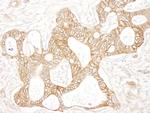 Beta-catenin Antibody in Immunohistochemistry (Paraffin) (IHC (P))