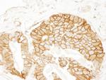 Beta-catenin Antibody in Immunohistochemistry (Paraffin) (IHC (P))