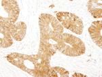 Beta-catenin Antibody in Immunohistochemistry (Paraffin) (IHC (P))