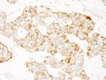 Prohibitin Antibody in Immunohistochemistry (Paraffin) (IHC (P))