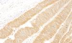 UVRAG Antibody in Immunohistochemistry (Paraffin) (IHC (P))