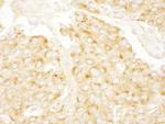 PRKAR2A/PKA-RIIalpha Antibody in Immunohistochemistry (Paraffin) (IHC (P))