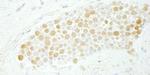 CDC5L Antibody in Immunohistochemistry (Paraffin) (IHC (P))