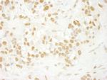 CDC5L Antibody in Immunohistochemistry (Paraffin) (IHC (P))