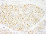 ZNF198 Antibody in Immunohistochemistry (Paraffin) (IHC (P))