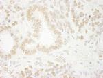 ZNF198 Antibody in Immunohistochemistry (Paraffin) (IHC (P))