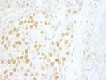 ZNF198 Antibody in Immunohistochemistry (Paraffin) (IHC (P))