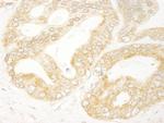 eIF4H Antibody in Immunohistochemistry (Paraffin) (IHC (P))