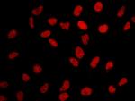 BRD2 Antibody in Immunocytochemistry (ICC/IF)