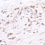 BRD2 Antibody in Immunohistochemistry (Paraffin) (IHC (P))