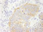 eIF2beta/EIF2S2 Antibody in Immunohistochemistry (Paraffin) (IHC (P))